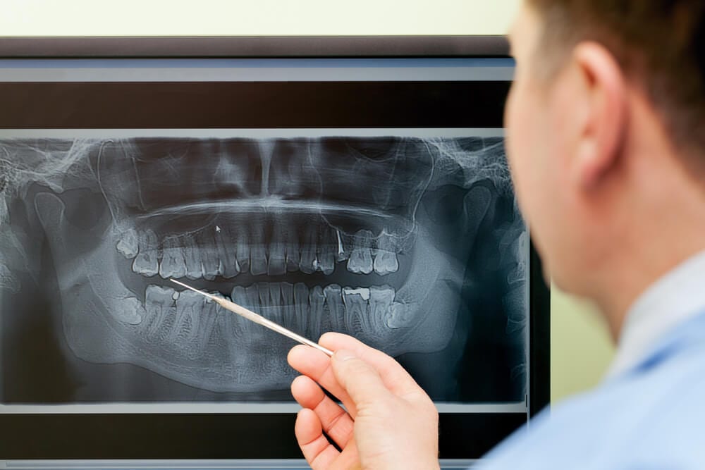 dentist examining a digital x ray film
