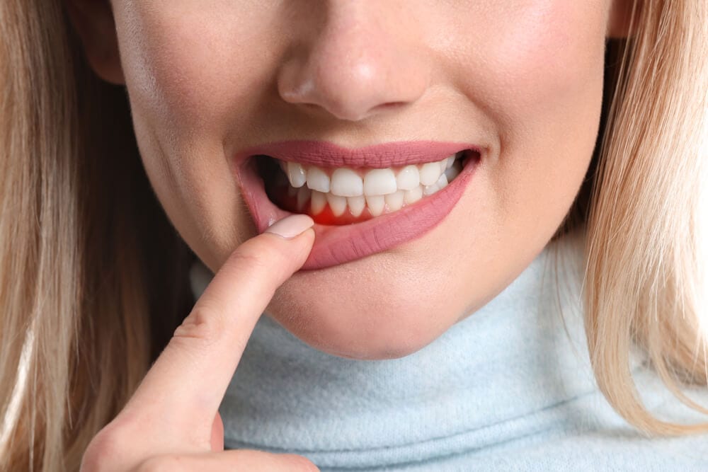 woman holding gum due to periodontal pain