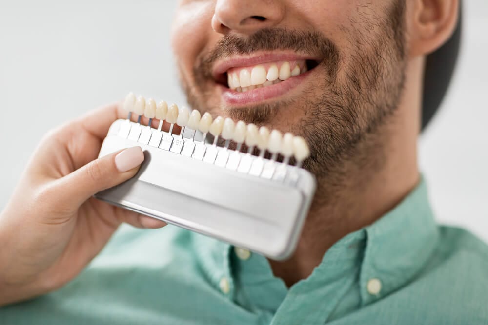 male smiling while dentist is examining teeth using veneer gradient