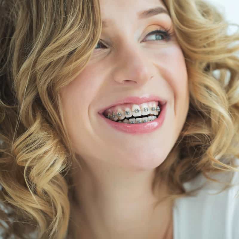 smiling adult with braces